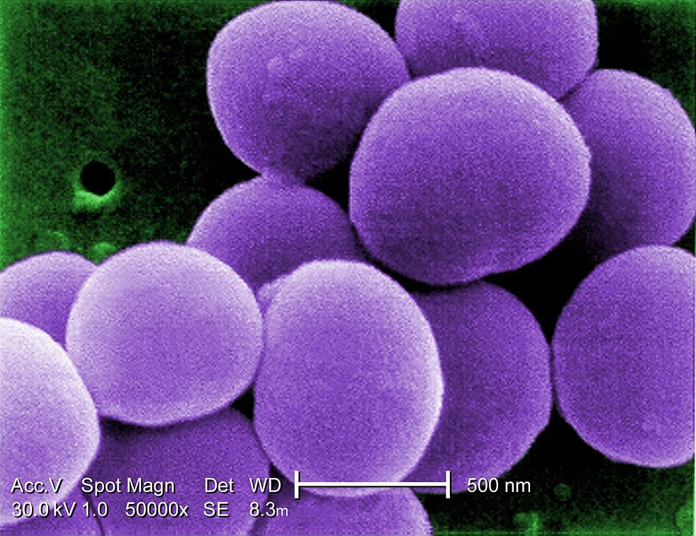 superbug virus