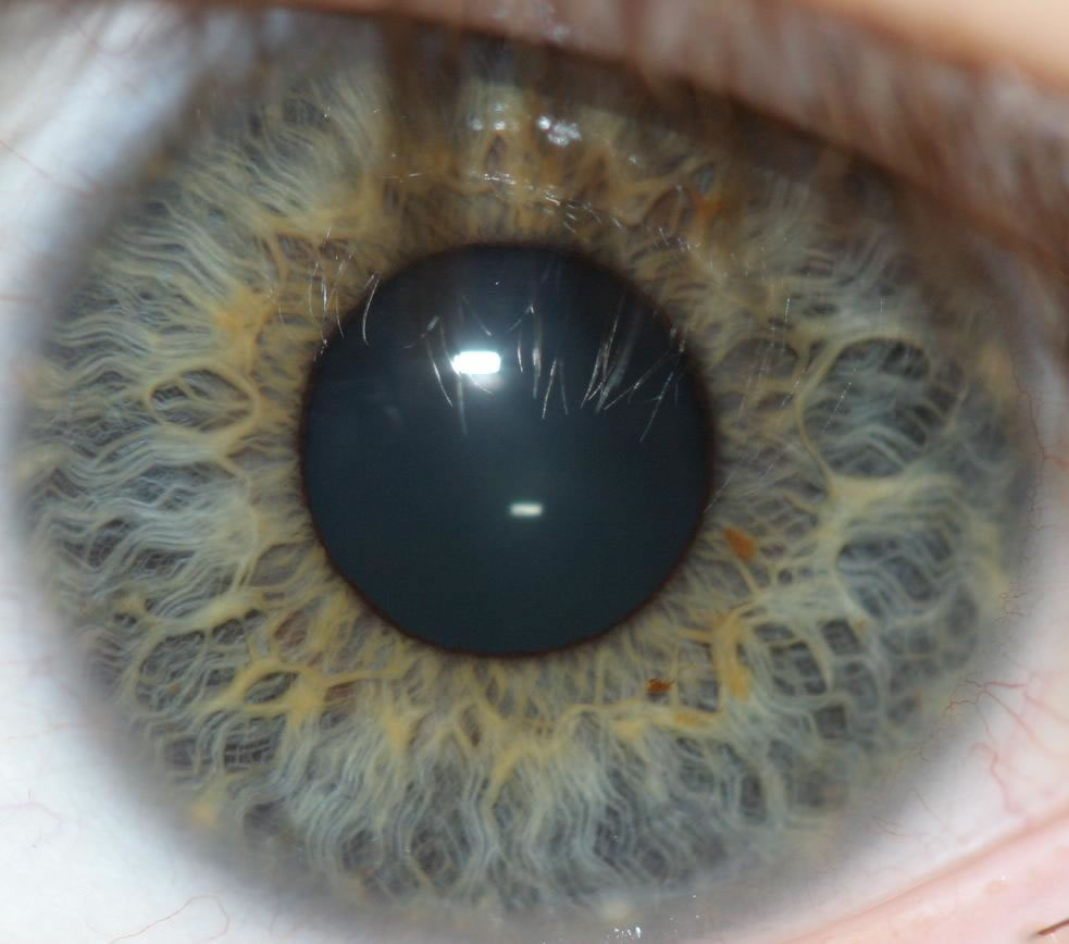 biometric identification iris recognition